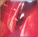 Anna Calvi – Hunter LP vinyl record, image 3 of 10